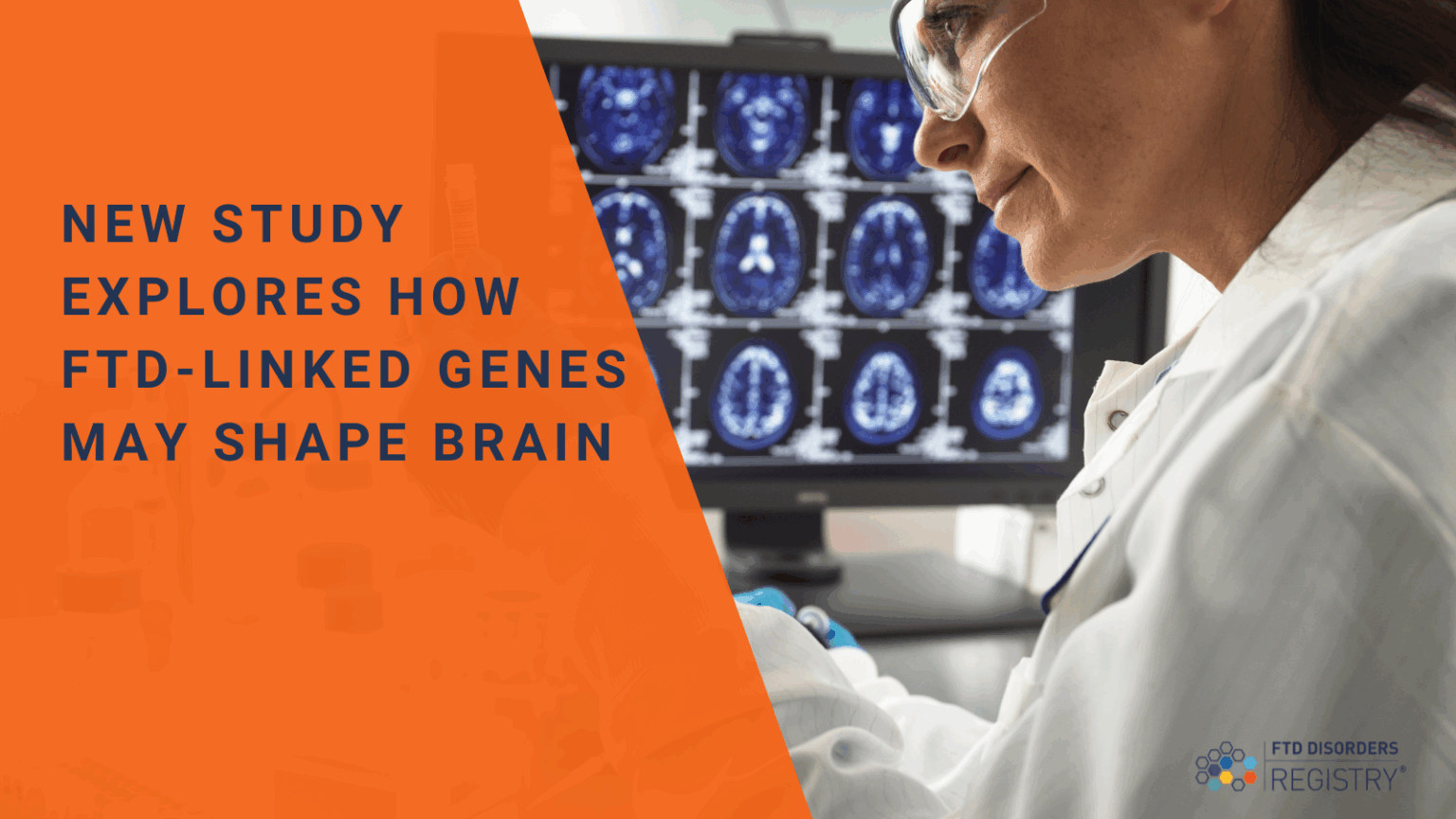 New Study Explores How FTD-Linked Genes May Shape Brain – FTD Disorders ...
